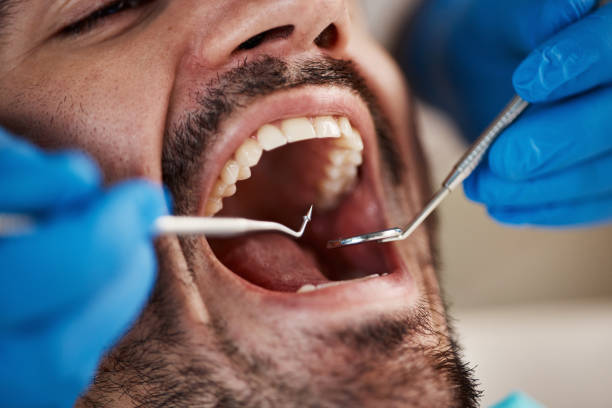 Best Walk-In Emergency Dentist in Murphy, MO